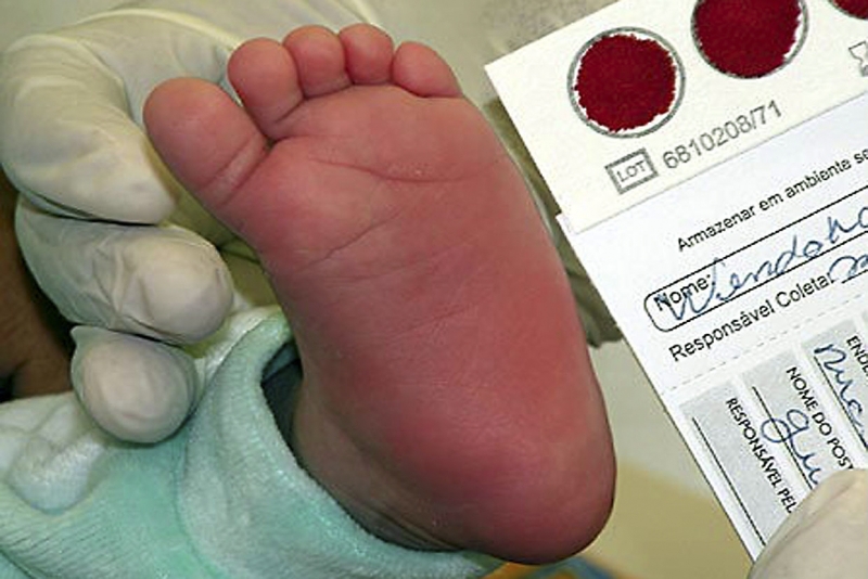 Teste do pezinho ajuda a diagnosticar doenças raras