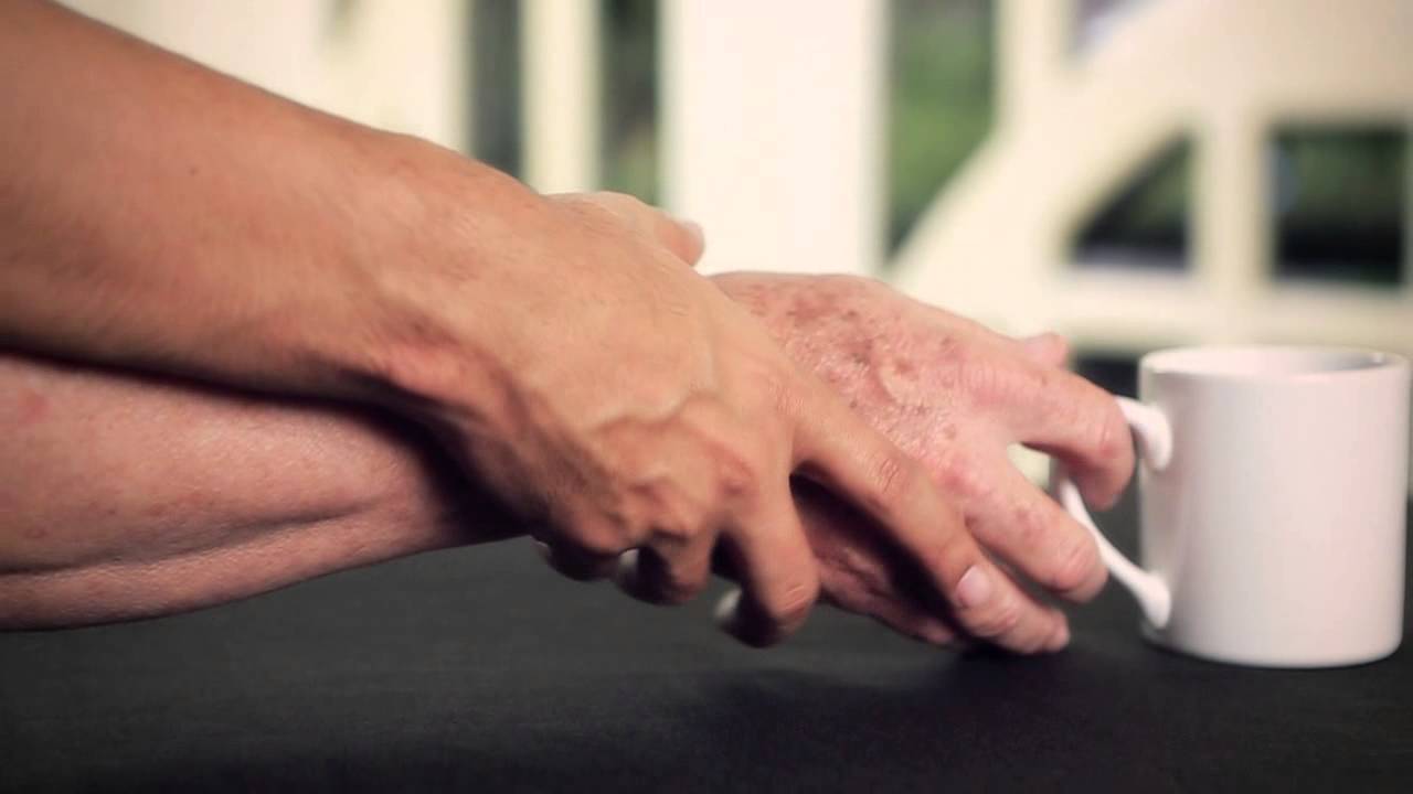 Associação Brasil Parkinson celebra os 200 anos do primeiro diagnóstico da doença