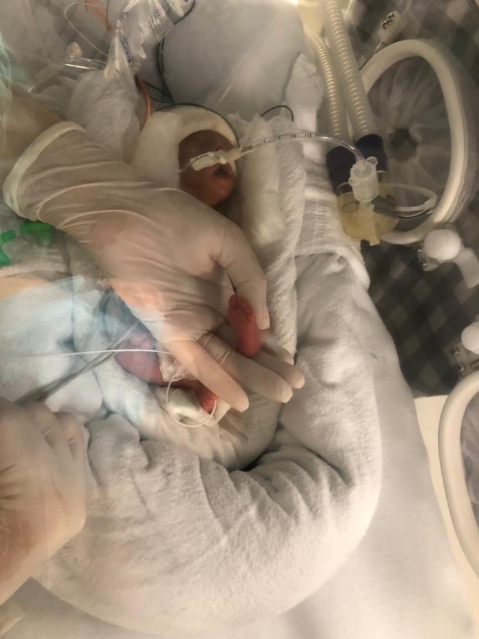 Bebê nascida com menos de meio quilo recebe alta da Maternidade Odete Valadares, em BH