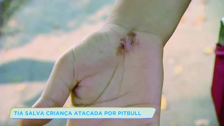 Tia salva criança de ataque de Pitbull