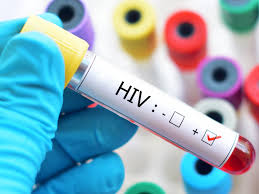 HIV: Brasil cumpre meta de pessoas em tratamento antirretroviral