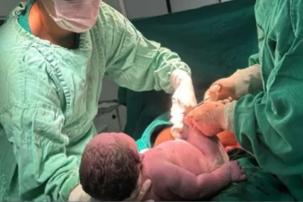 Bebê gigante nasce com 6,2 kg em Minas Gerais e quebra recorde de hospital