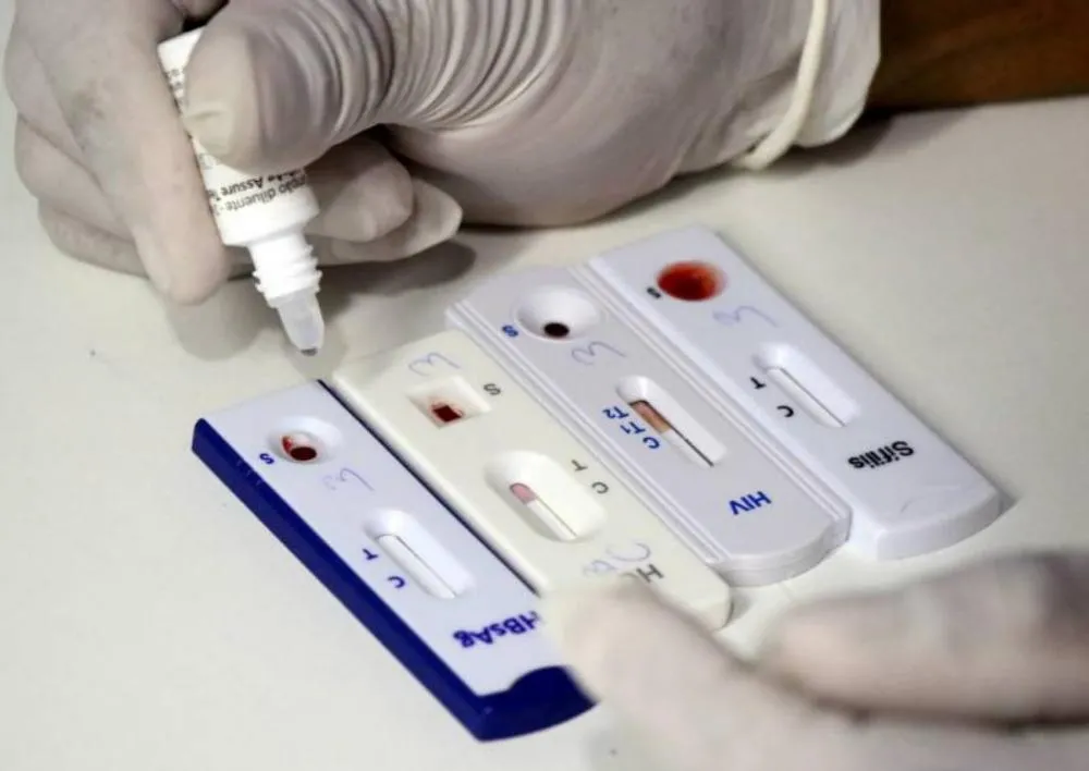 HIV: Prefeitura de Sabará oferece PrEP gratuita, testes rápidos e prevenção contra o vírus