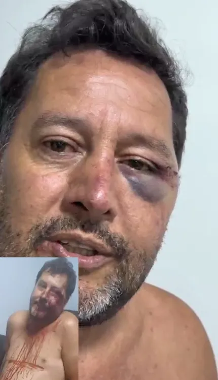 REPRODUÇÃO REDES SOCIAIS